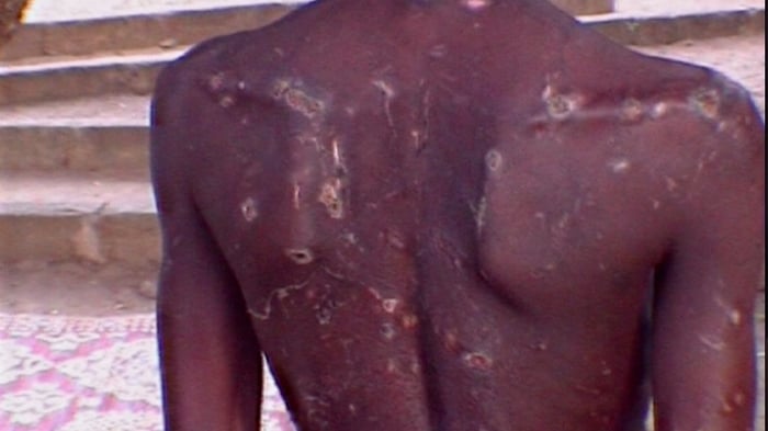 Slavery: A Global Investigation